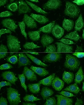 NDUFB3 Antibody