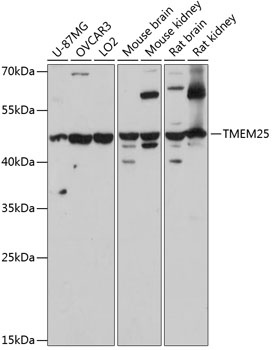 TMEM25 Antibody