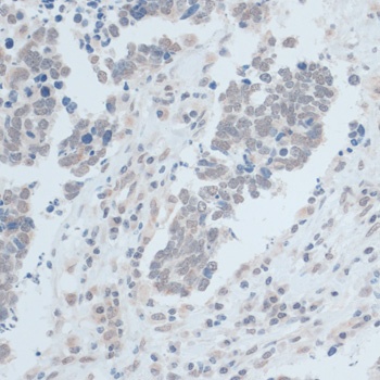 ZNF703 Antibody