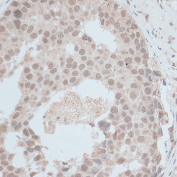 ZNF703 Antibody