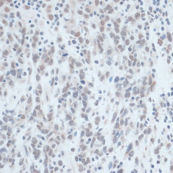 ZNF703 Antibody