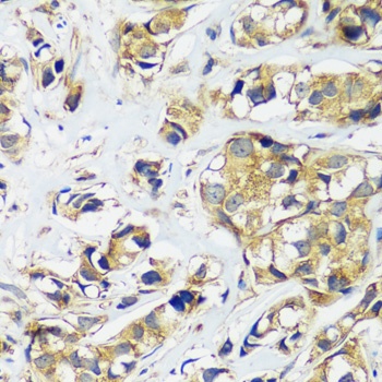 CCDC124 Antibody