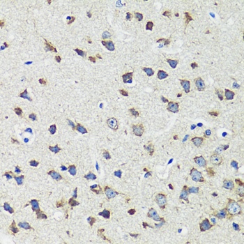 CCDC124 Antibody