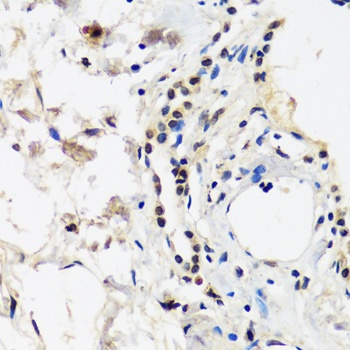 CAND1 Antibody