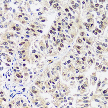 CAND1 Antibody