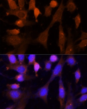 VPS26A Antibody