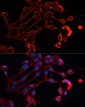 ADAM11 Antibody