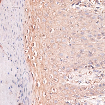 CDH3 Antibody