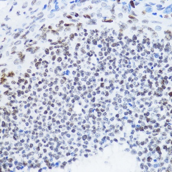 Acetyl-Histone H4-K12 pAb