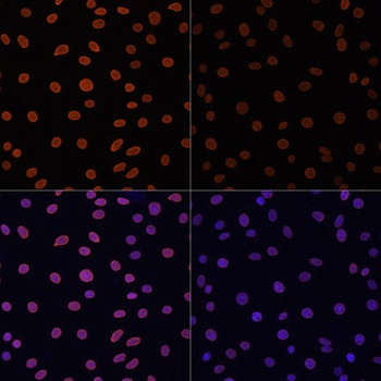 H4K12ac Antibody