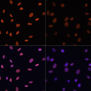 H4K12ac Antibody