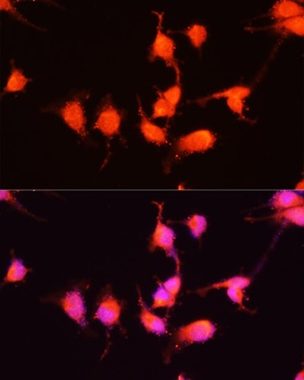 NGF Antibody