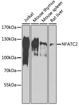 NFATC2 Antibody