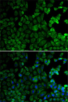 MSR1 Antibody