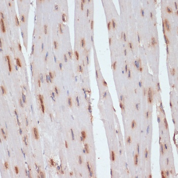 ESRRA Antibody