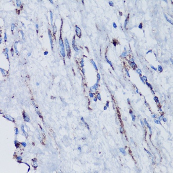 ESRRA Antibody