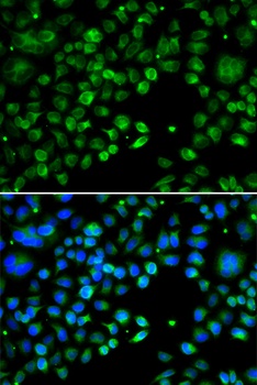 TXNDC5 Antibody