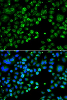 TXNDC5 Antibody