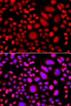 PRKAG3 Antibody