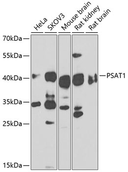 PSAT1 Antibody