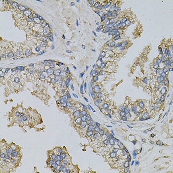 PSAT1 Antibody