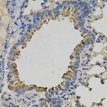 PSAT1 Antibody