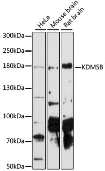 KDM5B Antibody