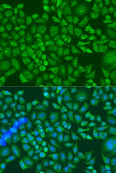 IGF2BP2 Antibody