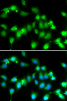 AKAP5 Antibody