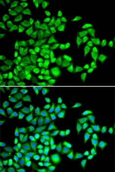 ALKBH1 Antibody