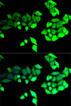 BEST1 Antibody