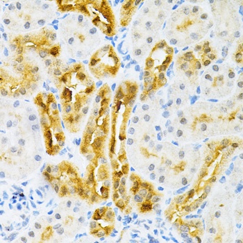 SULT2A1 Antibody