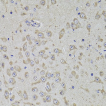 RPL3 Antibody