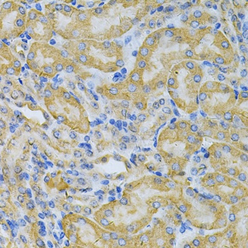 PGK1 Antibody