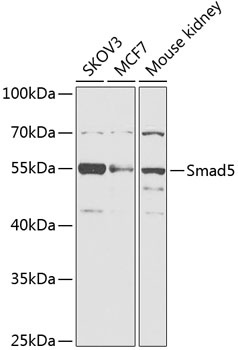 Smad5 Antibody