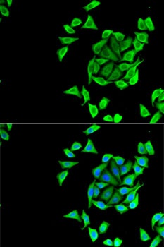 KCNN3 Antibody