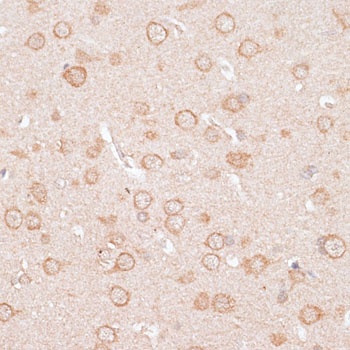 KCNJ4 Antibody