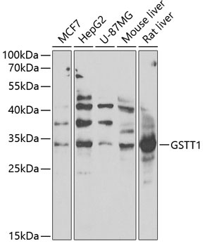 GSTT1 Antibody