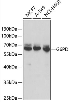 G6PD Antibody