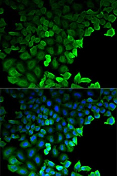 G6PD Antibody