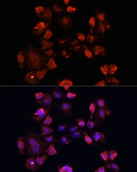 DAZL Antibody