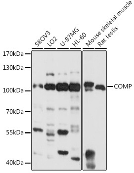 COMP Antibody