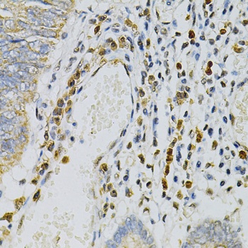 CDA Antibody