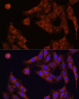 CDA Antibody