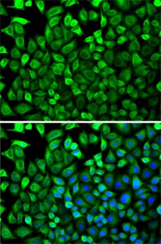 CDA Antibody