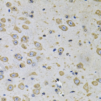 RHOA Antibody