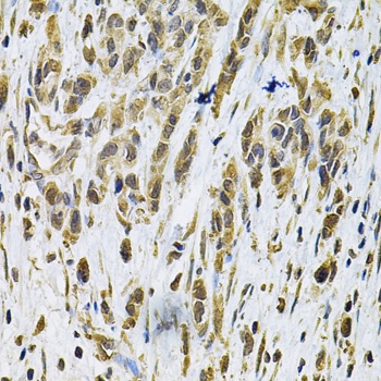 RHOA Antibody