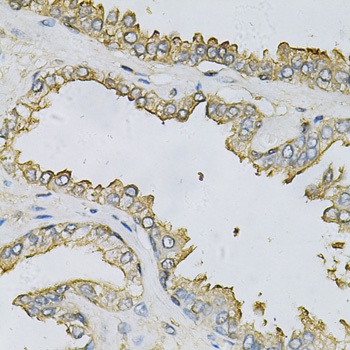 APRT Antibody