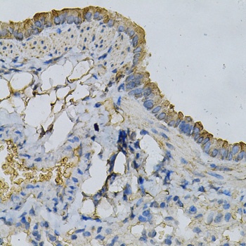APRT Antibody