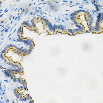 AKR1B1 Antibody